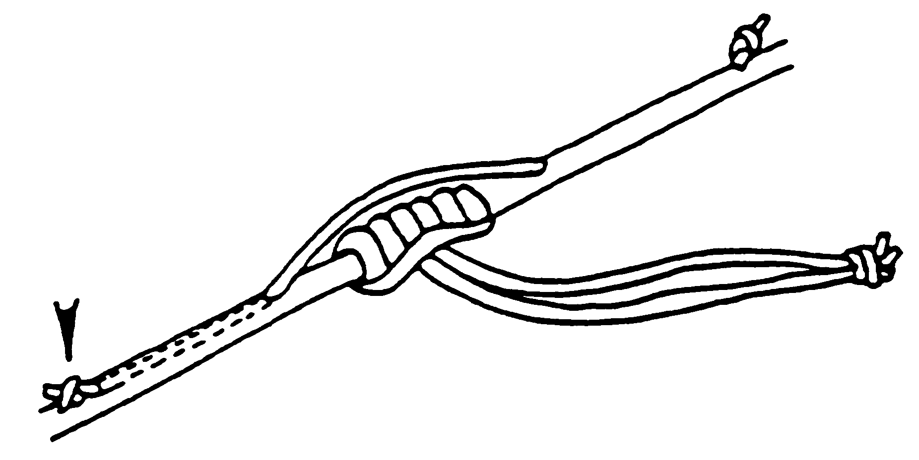 Inserted loop diag. 2